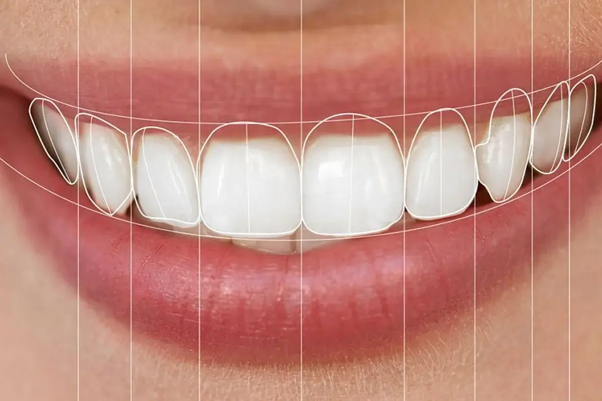 Cosmetic Dentistry