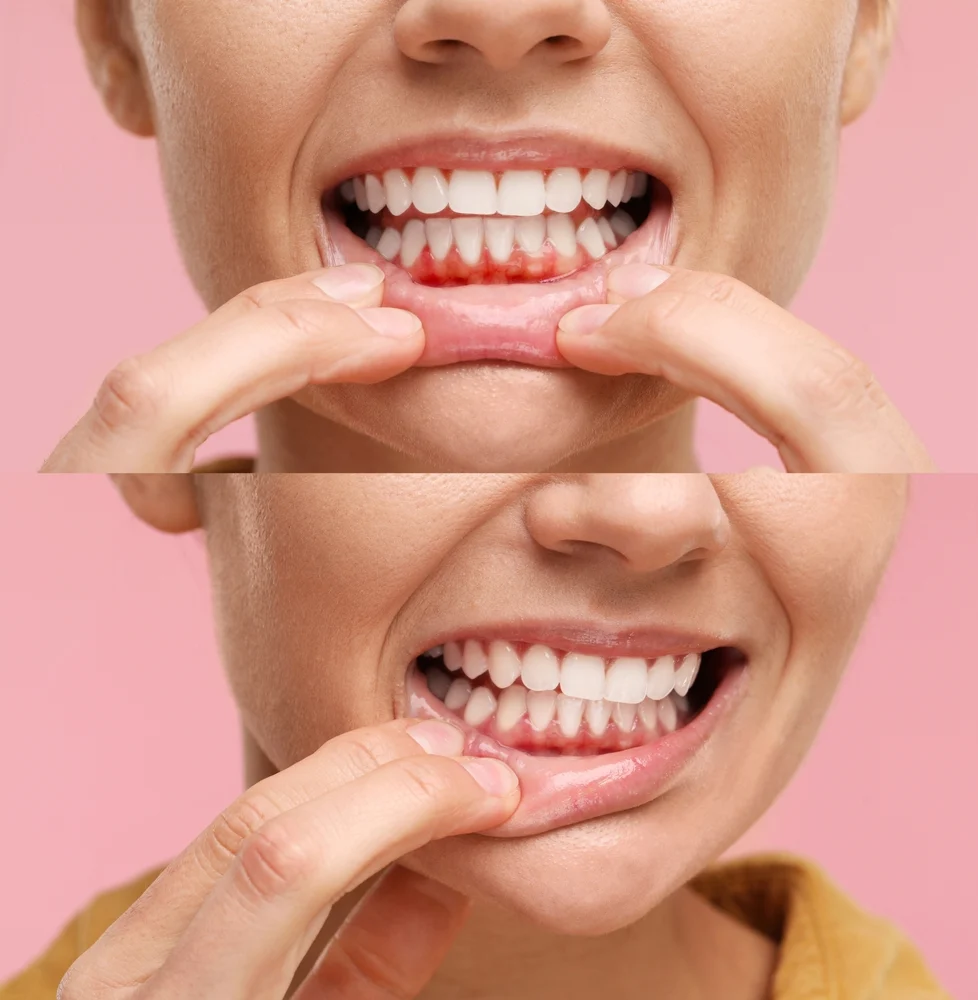 Gum Care & Periodontics